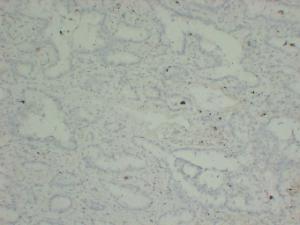 Anti-p63 Protein + HMW Cytokeratin Mouse Monoclonal Antibody [clone: ABT-P40]