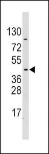 Anti-Pyruvate Dehydrogenase Kinase Isoform 4 Rabbit Polyclonal Antibody (AP (Alkaline Phosphatase))