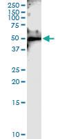 Anti-NEUROD1 Rabbit Polyclonal Antibody