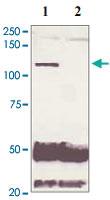 Anti-AR Rabbit Polyclonal Antibody