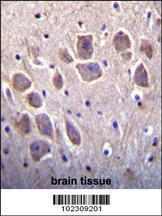 Anti-RCAN2 Rabbit Polyclonal Antibody (APC (Allophycocyanin))