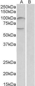 Anti-UNC5B Antibody (A84992) (2µg/ml) staining of Human Bone Marrow lysate (35µg protein in RIPA buffer) with (B) and without (A) blocking with the immunizing peptide. Primary incubation was 1 hour. Detected by chemiluminescence.