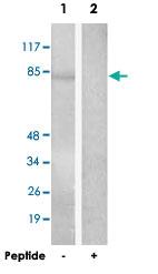 Anti-ZNF225 Rabbit Polyclonal Antibody