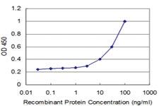 Anti-TTK Mouse Monoclonal Antibody [clone: 2F1]