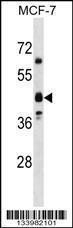 Anti-OR5M8 Rabbit Polyclonal Antibody (AP (Alkaline Phosphatase))