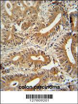 Anti-CEP89 Rabbit Polyclonal Antibody