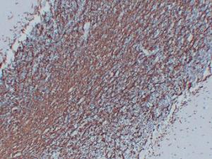 Anti-Myelin Basic Protein Mouse Monoclonal Antibody [clone: ABT-MBP]