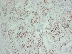 Anti-p63 Protein + HMW Cytokeratin Mouse Monoclonal Antibody [clone: ABT-P40]