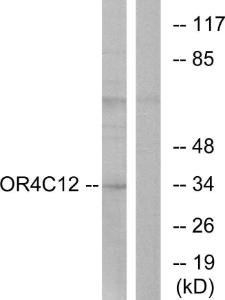 Western blot analysis of lysates from Jurkat cells using Anti-OR4C12 Antibody. The right hand lane represents a negative control, where the antibody is blocked by the immunising peptide