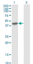 Anti-FCER2 Mouse Monoclonal Antibody [clone: S51]