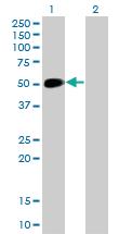 Anti-NEUROD1 Mouse Monoclonal Antibody [clone: 3H8]