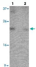 Anti-B9D1 Rabbit Polyclonal Antibody