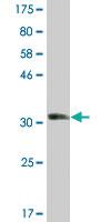 Anti-STMN2 Mouse Monoclonal Antibody [clone: 2B2]