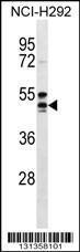 Anti-HCAR2 Rabbit Polyclonal Antibody (APC (Allophycocyanin))