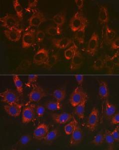 Immunofluorescence analysis of NIH/3T3 cells using Anti-Fibronectin Antibody [ARC2692] (A93062) at a dilution of 1:50 (40x lens). DAPI was used to stain the cell nuclei (blue)