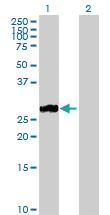 Anti-MMP7 Rabbit Polyclonal Antibody