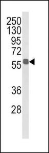 Anti-ALDH3B1 Rabbit Polyclonal Antibody (AP (Alkaline Phosphatase))