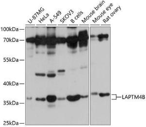 Western blot analysis of extracts of various cell lines, using Anti-LAPTM4B Antibody (A8793) at 1:1,000 dilution. The secondary antibody was Goat Anti-Rabbit IgG H&L Antibody (HRP) at 1:10,000 dilution.