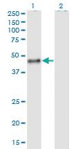 Anti-CALU Mouse Monoclonal Antibody [clone: 6C8]