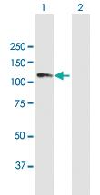 Anti-ANKRD20A1 Mouse Polyclonal Antibody