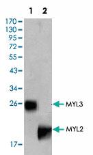 Anti-MYL2 Mouse Monoclonal Antibody [clone: 7C9]