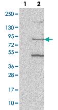 Anti-PATL1 Rabbit Polyclonal Antibody