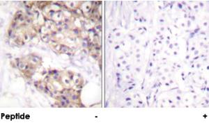 Anti-PAK2 Rabbit Polyclonal Antibody