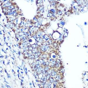 Anti-ATP5A Rabbit Monoclonal Antibody [clone: ARC0549]