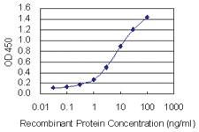 Anti-CALU Mouse Monoclonal Antibody [clone: 6C8]