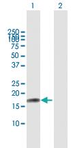 Anti-IL17F Mouse Polyclonal Antibody