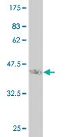 Anti-STMN2 Mouse Monoclonal Antibody [clone: 2G11]