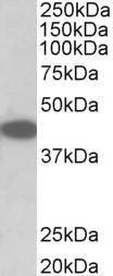 Anti-Trib1 antibody