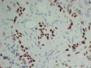 Anti-p63 Protein + HMW Cytokeratin Mouse Monoclonal Antibody [clone: ABT-P40]