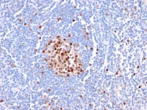 Immunohistochemical analysis of formalin-fixed, paraffin-embedded human tonsil using Anti-PCNA Antibody [PC5]