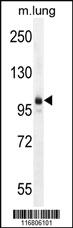 Anti-AEBP1 Rabbit Polyclonal Antibody