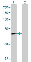 Anti-FGL2 Rabbit Polyclonal Antibody