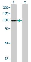 Anti-ATP2C1 Mouse Polyclonal Antibody