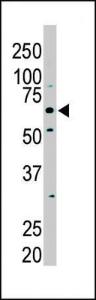 Anti-PKLR Rabbit Polyclonal Antibody (APC (Allophycocyanin))