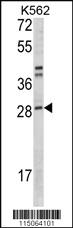 Anti-NMRK2 Rabbit Polyclonal Antibody