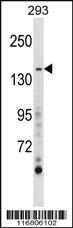 Anti-AEBP1 Rabbit Polyclonal Antibody