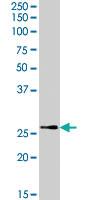 Anti-TPD52L1 Goat Polyclonal Antibody