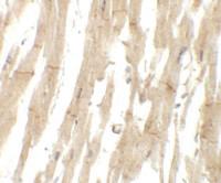 Anti-MLIP Rabbit Polyclonal Antibody