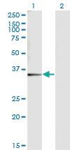 Anti-SNX11 Mouse Monoclonal Antibody [clone: 2G1]