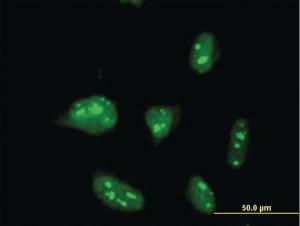 Anti-ZNF611 Mouse Monoclonal Antibody [clone: 4F1]