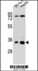 Anti-MTHFD2L Rabbit Polyclonal Antibody (APC (Allophycocyanin))