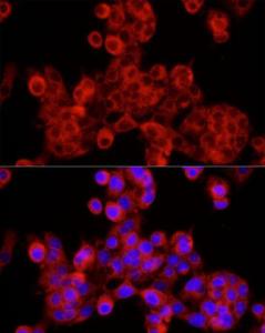 Immunofluorescence analysis of HepG2 cells using Anti-Sec24C Antibody (A8802) at a dilution of 1:100 (40X lens). DAPI was used to stain the cell nuclei (blue)