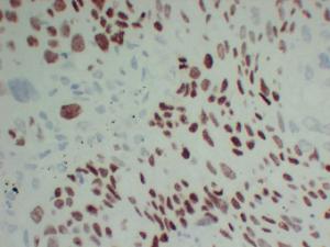 Anti-p63 Protein + HMW Cytokeratin Mouse Monoclonal Antibody [clone: ABT-P40]