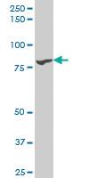 Anti-TTK Mouse Monoclonal Antibody [clone: X1]