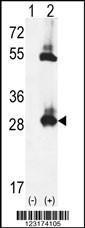 Anti-TPK1 Rabbit Polyclonal Antibody (AP (Alkaline Phosphatase))