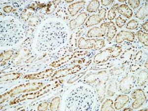 Anti-Alpha B Crystallin Rabbit Polyclonal Antibody